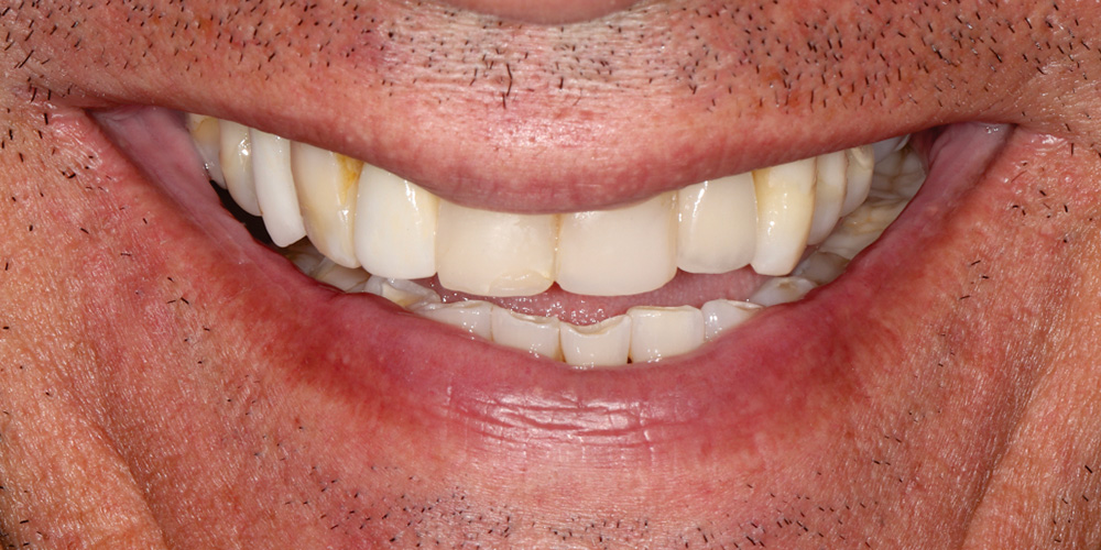 Sorriso antes do tratamento